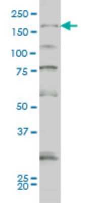 Western Blot: Synaptojanin 1 Antibody (1A2) [H00008867-M01]