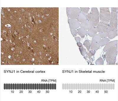 Immunohistochemistry-Paraffin: Synaptojanin 1 Antibody [NBP1-87842]