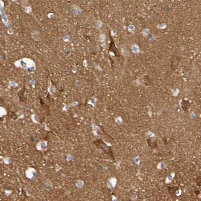 Immunohistochemistry-Paraffin: Synaptojanin 1 Antibody [NBP1-87842]