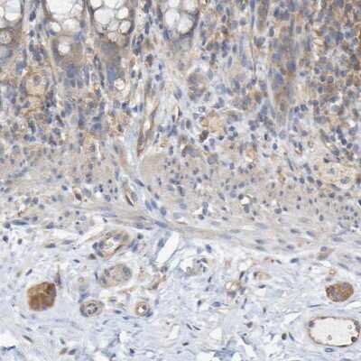 Immunohistochemistry-Paraffin: Synaptojanin 1 Antibody [NBP1-87842]