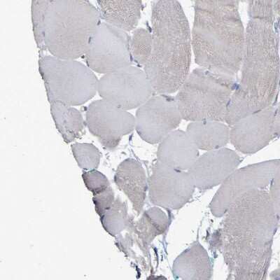 Immunohistochemistry-Paraffin: Synaptojanin 1 Antibody [NBP1-87842]