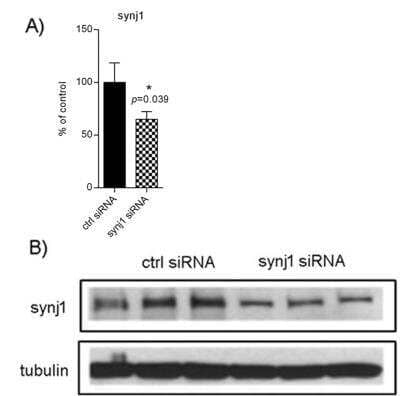 Knockdown Validated: Synaptojanin 1 Antibody [NBP1-87842]