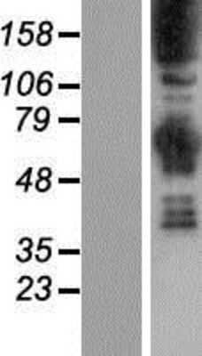 Western Blot: Synaptojanin 1 Overexpression Lysate [NBP2-04553]