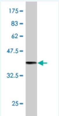 Western Blot: Synaptojanin 2 Antibody (2B11) [H00008871-M03]