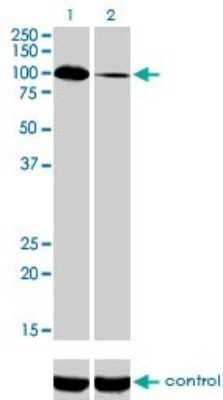 Western Blot: Synaptojanin 2 Antibody (2H8) [H00008871-M02]