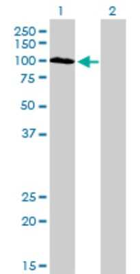 Western Blot: Synaptojanin 2 Antibody (2H8) [H00008871-M02]