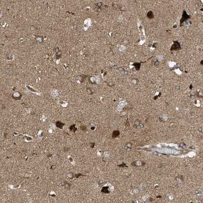 Immunohistochemistry-Paraffin: Synaptojanin 2 Antibody [NBP1-87843]