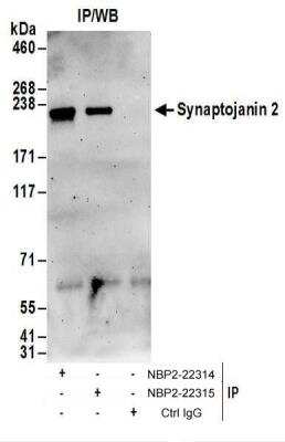 Immunoprecipitation: Synaptojanin 2 Antibody [NBP2-22314]