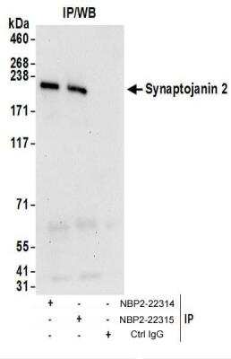 Immunoprecipitation: Synaptojanin 2 Antibody [NBP2-22315]