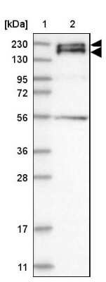 Western Blot: Synaptojanin 2 Antibody [NBP1-87843]