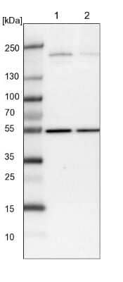 Western Blot: Synaptojanin 2 Antibody [NBP1-87843]