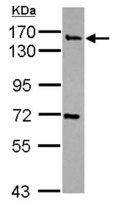 Western Blot: Synaptojanin 2 Antibody [NBP2-20543]