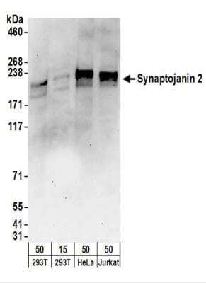 Western Blot: Synaptojanin 2 Antibody [NBP2-22314]