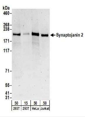 Western Blot: Synaptojanin 2 Antibody [NBP2-22315]