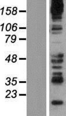 Western Blot: Synaptojanin 2 Overexpression Lysate [NBP2-10552]