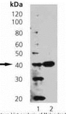 Western Blot: Synaptophysin Antibody (EP10) [NBP1-19222]