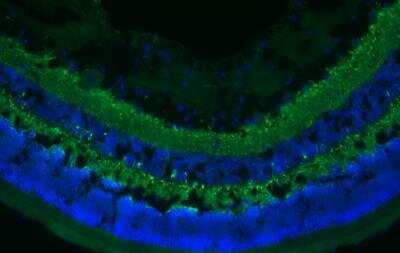 Immunohistochemistry-Frozen: Synaptophysin Antibody [NB300-653]