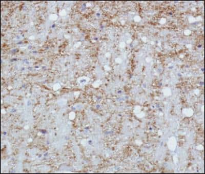 Immunohistochemistry: Synaptophysin Antibody - BSA Free [NBP2-25170]