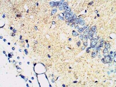 Immunohistochemistry-Paraffin: Synaptophysin Antibody [NB300-653]