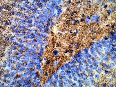 Immunohistochemistry-Paraffin: Synaptophysin Antibody [NB300-653]
