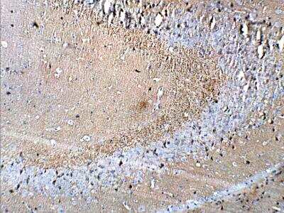 Immunohistochemistry-Paraffin: Synaptophysin Antibody [NB300-653]