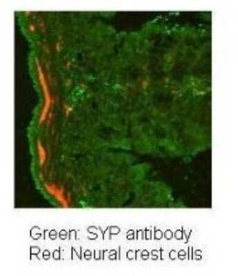 Immunohistochemistry-Paraffin: Synaptophysin Antibody [NBP1-59660]