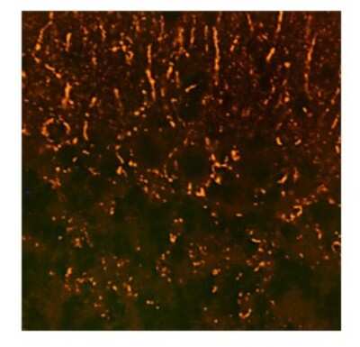 Immunohistochemistry-Paraffin: Synaptophysin Antibody [NBP1-59660]