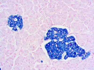 Immunohistochemistry-Paraffin: Synaptophysin Antibody (SP11) [NB120-16659]