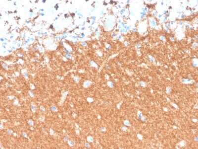 Immunohistochemistry-Paraffin: Synaptophysin Antibody (SYP/4503R) - Azide and BSA Free [NBP3-08213]