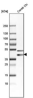 Western Blot: Synaptophysin Antibody [NBP1-88112]