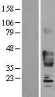 Western Blot: Synaptophysin Overexpression Lysate [NBL1-16644]