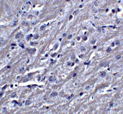 Immunohistochemistry: Synaptopodin Antibody - BSA Free [NBP2-39100]