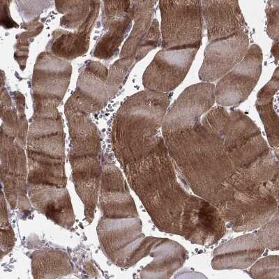 Immunohistochemistry: Synaptopodin Antibody [NBP2-68919]