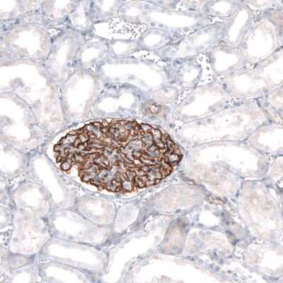 Immunohistochemistry-Paraffin: Synaptopodin Antibody [NBP1-87887]