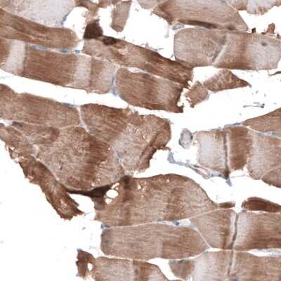 Immunohistochemistry-Paraffin: Synaptopodin Antibody [NBP1-87887]