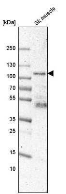 Western Blot: Synaptopodin Antibody [NBP1-87887]