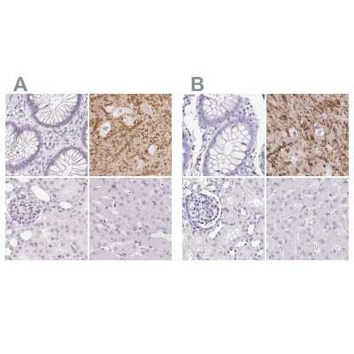 Immunohistochemistry-Paraffin: Synaptoporin Antibody [NBP2-13405]