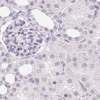 Immunohistochemistry-Paraffin: Synaptoporin Antibody [NBP2-13405]
