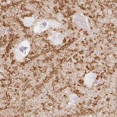 Immunohistochemistry-Paraffin: Synaptoporin Antibody [NBP2-13405]