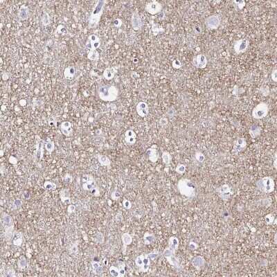 Immunohistochemistry-Paraffin: Synaptoporin Antibody [NBP2-38932]