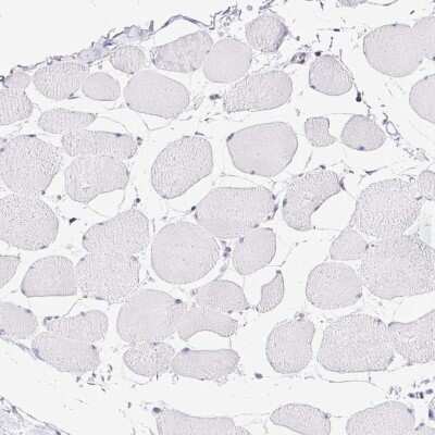 Immunohistochemistry-Paraffin: Synaptoporin Antibody [NBP2-38932]