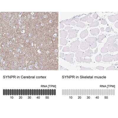 Immunohistochemistry-Paraffin: Synaptoporin Antibody [NBP2-38932]