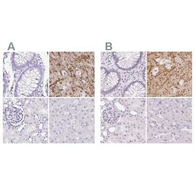 Immunohistochemistry-Paraffin: Synaptoporin Antibody [NBP2-38932]