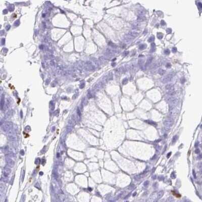 Immunohistochemistry-Paraffin: Synaptoporin Antibody [NBP2-38932]