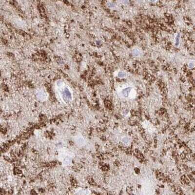 Immunohistochemistry-Paraffin: Synaptoporin Antibody [NBP2-38932]