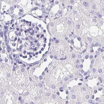 Immunohistochemistry-Paraffin: Synaptoporin Antibody [NBP2-38932]