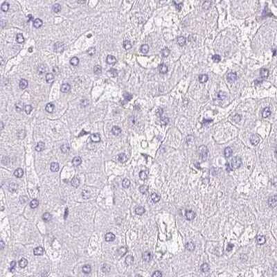 Immunohistochemistry-Paraffin: Synaptoporin Antibody [NBP2-38932]