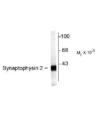 Western Blot: Synaptoporin Antibody [NB300-738]