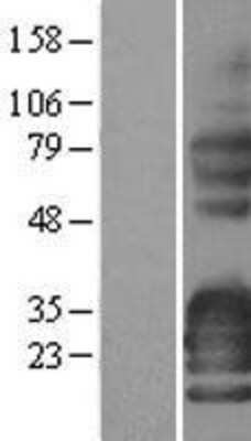 Western Blot: Synaptoporin Overexpression Lysate [NBL1-16643]