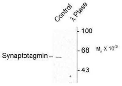 Western Blot: Synaptotagmin 1 [p Ser309] Antibody [NB300-236]